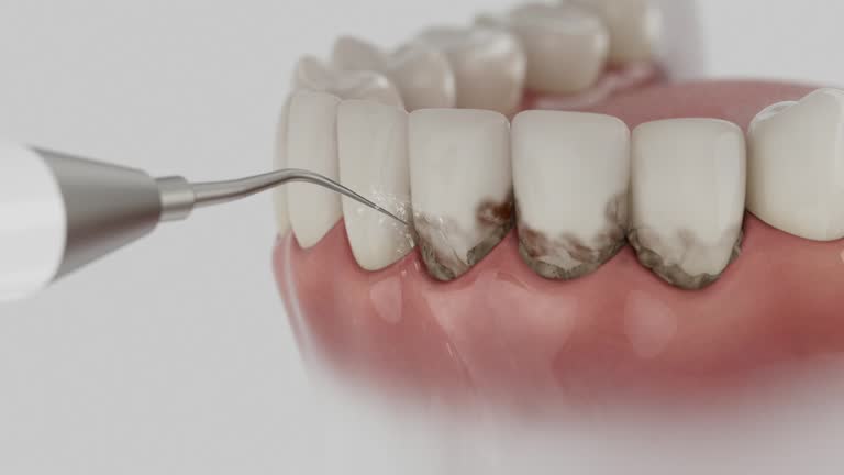 Reliable Dental Implants contractor in Haverhill, MA by Smile Center Dentistry